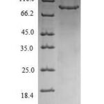 SDS-PAGE separation of QP5830 followed by commassie total protein stain results in a primary band consistent with reported data for CHM. These data demonstrate Greater than 90% as determined by SDS-PAGE.