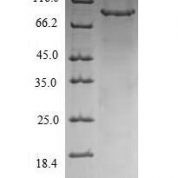 SDS-PAGE separation of QP5830 followed by commassie total protein stain results in a primary band consistent with reported data for CHM. These data demonstrate Greater than 90% as determined by SDS-PAGE.