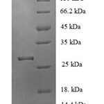 SDS-PAGE separation of QP5833 followed by commassie total protein stain results in a primary band consistent with reported data for Acetylcholine receptor subunit alpha. These data demonstrate Greater than 80% as determined by SDS-PAGE.