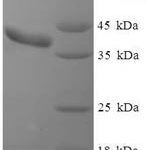 SDS-PAGE separation of QP5841 followed by commassie total protein stain results in a primary band consistent with reported data for Clathrin light chain A. These data demonstrate Greater than 90% as determined by SDS-PAGE.