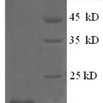 SDS-PAGE separation of QP5851 followed by commassie total protein stain results in a primary band consistent with reported data for Collagen alpha-1(XII) chain. These data demonstrate Greater than 90% as determined by SDS-PAGE.