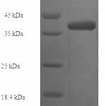 SDS-PAGE separation of QP5852 followed by commassie total protein stain results in a primary band consistent with reported data for Collagen alpha-1(IV) chain. These data demonstrate Greater than 90% as determined by SDS-PAGE.