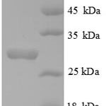 SDS-PAGE separation of QP5853 followed by commassie total protein stain results in a primary band consistent with reported data for COL4A3. These data demonstrate Greater than 90% as determined by SDS-PAGE.