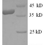 SDS-PAGE separation of QP5856 followed by commassie total protein stain results in a primary band consistent with reported data for Mast cell carboxypeptidase A. These data demonstrate Greater than 90% as determined by SDS-PAGE.