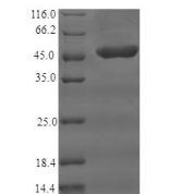 SDS-PAGE separation of QP5860 followed by commassie total protein stain results in a primary band consistent with reported data for CD35 / CR1. These data demonstrate Greater than 90% as determined by SDS-PAGE.