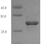 SDS-PAGE separation of QP5861 followed by commassie total protein stain results in a primary band consistent with reported data for CD21 / CR2 / C3DR. These data demonstrate Greater than 90% as determined by SDS-PAGE.