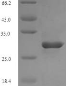 SDS-PAGE separation of QP5861 followed by commassie total protein stain results in a primary band consistent with reported data for CD21 / CR2 / C3DR. These data demonstrate Greater than 90% as determined by SDS-PAGE.