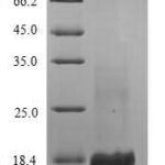 SDS-PAGE separation of QP5862 followed by commassie total protein stain results in a primary band consistent with reported data for CD21 / CR2 / C3DR. These data demonstrate Greater than 90% as determined by SDS-PAGE.