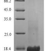 SDS-PAGE separation of QP5862 followed by commassie total protein stain results in a primary band consistent with reported data for CD21 / CR2 / C3DR. These data demonstrate Greater than 90% as determined by SDS-PAGE.