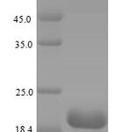 SDS-PAGE separation of QP5863 followed by commassie total protein stain results in a primary band consistent with reported data for CD21 / CR2 / C3DR. These data demonstrate Greater than 90% as determined by SDS-PAGE.