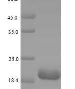 SDS-PAGE separation of QP5863 followed by commassie total protein stain results in a primary band consistent with reported data for CD21 / CR2 / C3DR. These data demonstrate Greater than 90% as determined by SDS-PAGE.