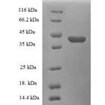 SDS-PAGE separation of QP5864 followed by commassie total protein stain results in a primary band consistent with reported data for CRABP1 / RBP5. These data demonstrate Greater than 90% as determined by SDS-PAGE.