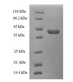 SDS-PAGE separation of QP5864 followed by commassie total protein stain results in a primary band consistent with reported data for CRABP1 / RBP5. These data demonstrate Greater than 90% as determined by SDS-PAGE.