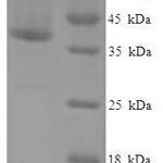 SDS-PAGE separation of QP5865 followed by commassie total protein stain results in a primary band consistent with reported data for CRADD / RAIDD. These data demonstrate Greater than 90% as determined by SDS-PAGE.