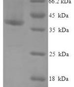SDS-PAGE separation of QP5865 followed by commassie total protein stain results in a primary band consistent with reported data for CRADD / RAIDD. These data demonstrate Greater than 90% as determined by SDS-PAGE.