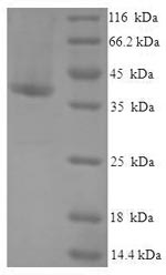 SDS-PAGE separation of QP5865 followed by commassie total protein stain results in a primary band consistent with reported data for CRADD / RAIDD. These data demonstrate Greater than 90% as determined by SDS-PAGE.