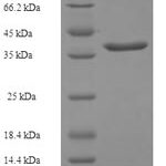 SDS-PAGE separation of QP5869 followed by commassie total protein stain results in a primary band consistent with reported data for CRIP2. These data demonstrate Greater than 90% as determined by SDS-PAGE.