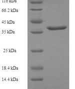 SDS-PAGE separation of QP5869 followed by commassie total protein stain results in a primary band consistent with reported data for CRIP2. These data demonstrate Greater than 90% as determined by SDS-PAGE.