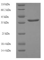 SDS-PAGE separation of QP5869 followed by commassie total protein stain results in a primary band consistent with reported data for CRIP2. These data demonstrate Greater than 90% as determined by SDS-PAGE.