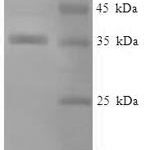 SDS-PAGE separation of QP5870 followed by commassie total protein stain results in a primary band consistent with reported data for Alpha-crystallin B chain. These data demonstrate Greater than 90% as determined by SDS-PAGE.