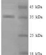 SDS-PAGE separation of QP5870 followed by commassie total protein stain results in a primary band consistent with reported data for Alpha-crystallin B chain. These data demonstrate Greater than 90% as determined by SDS-PAGE.