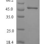 SDS-PAGE separation of QP5872 followed by commassie total protein stain results in a primary band consistent with reported data for Beta-crystallin S. These data demonstrate Greater than 80% as determined by SDS-PAGE.