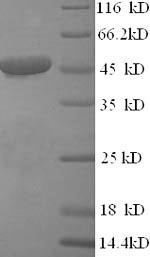 SDS-PAGE separation of QP5873 followed by commassie total protein stain results in a primary band consistent with reported data for Citrate synthase / CS. These data demonstrate Greater than 90% as determined by SDS-PAGE.
