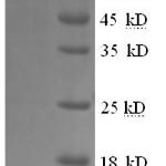 SDS-PAGE separation of QP5875 followed by commassie total protein stain results in a primary band consistent with reported data for CSF1R / MCSF Receptor / CD115. These data demonstrate Greater than 90% as determined by SDS-PAGE.