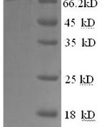 SDS-PAGE separation of QP5875 followed by commassie total protein stain results in a primary band consistent with reported data for CSF1R / MCSF Receptor / CD115. These data demonstrate Greater than 90% as determined by SDS-PAGE.