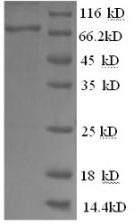 SDS-PAGE separation of QP5875 followed by commassie total protein stain results in a primary band consistent with reported data for CSF1R / MCSF Receptor / CD115. These data demonstrate Greater than 90% as determined by SDS-PAGE.
