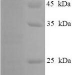 SDS-PAGE separation of QP5877 followed by commassie total protein stain results in a primary band consistent with reported data for CSF2RA / GM-CSFR / CD116. These data demonstrate Greater than 90% as determined by SDS-PAGE.