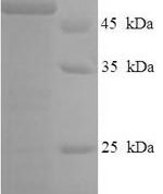 SDS-PAGE separation of QP5877 followed by commassie total protein stain results in a primary band consistent with reported data for CSF2RA / GM-CSFR / CD116. These data demonstrate Greater than 90% as determined by SDS-PAGE.