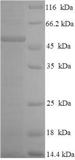 SDS-PAGE separation of QP5877 followed by commassie total protein stain results in a primary band consistent with reported data for CSF2RA / GM-CSFR / CD116. These data demonstrate Greater than 90% as determined by SDS-PAGE.