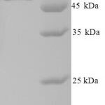 SDS-PAGE separation of QP5880 followed by commassie total protein stain results in a primary band consistent with reported data for Casein kinase I isoform epsilon. These data demonstrate Greater than 90% as determined by SDS-PAGE.