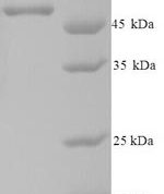 SDS-PAGE separation of QP5880 followed by commassie total protein stain results in a primary band consistent with reported data for Casein kinase I isoform epsilon. These data demonstrate Greater than 90% as determined by SDS-PAGE.