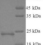 SDS-PAGE separation of QP5883 followed by commassie total protein stain results in a primary band consistent with reported data for Cancer / testis antigen 2. These data demonstrate Greater than 90% as determined by SDS-PAGE.