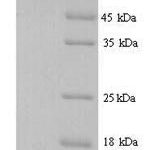 SDS-PAGE separation of QP5884 followed by commassie total protein stain results in a primary band consistent with reported data for Transcriptional repressor CTCFL. These data demonstrate Greater than 90% as determined by SDS-PAGE.