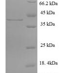 SDS-PAGE separation of QP5887 followed by commassie total protein stain results in a primary band consistent with reported data for Cathepsin G. These data demonstrate Greater than 90% as determined by SDS-PAGE.