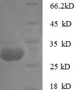 SDS-PAGE separation of QP5893 followed by commassie total protein stain results in a primary band consistent with reported data for Cathepsin K. These data demonstrate Greater than 90% as determined by SDS-PAGE.