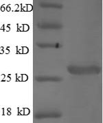 SDS-PAGE separation of QP5895 followed by commassie total protein stain results in a primary band consistent with reported data for Cathepsin S / CTSS. These data demonstrate Greater than 90% as determined by SDS-PAGE.