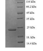 SDS-PAGE separation of QP5896 followed by commassie total protein stain results in a primary band consistent with reported data for Fractalkine / CX3CL1. These data demonstrate Greater than 90% as determined by SDS-PAGE.