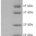 SDS-PAGE separation of QP5902 followed by commassie total protein stain results in a primary band consistent with reported data for CYP11A1. These data demonstrate Greater than 90% as determined by SDS-PAGE.