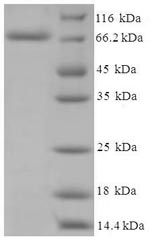 SDS-PAGE separation of QP5902 followed by commassie total protein stain results in a primary band consistent with reported data for CYP11A1. These data demonstrate Greater than 90% as determined by SDS-PAGE.