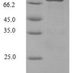 SDS-PAGE separation of QP5904 followed by commassie total protein stain results in a primary band consistent with reported data for Steroid 17-alpha-hydroxylase / 17