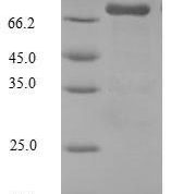 SDS-PAGE separation of QP5904 followed by commassie total protein stain results in a primary band consistent with reported data for Steroid 17-alpha-hydroxylase / 17
