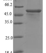 SDS-PAGE separation of QP5905 followed by commassie total protein stain results in a primary band consistent with reported data for Steroid 17-alpha-hydroxylase / 17