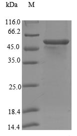 SDS-PAGE separation of QP5905 followed by commassie total protein stain results in a primary band consistent with reported data for Steroid 17-alpha-hydroxylase / 17