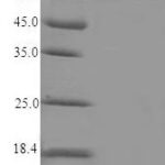 SDS-PAGE separation of QP5906 followed by commassie total protein stain results in a primary band consistent with reported data for Steroid 17-alpha-hydroxylase / 17