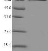 SDS-PAGE separation of QP5906 followed by commassie total protein stain results in a primary band consistent with reported data for Steroid 17-alpha-hydroxylase / 17