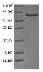 SDS-PAGE separation of QP5922 followed by commassie total protein stain results in a primary band consistent with reported data for Probable ATP-dependent RNA helicase DDX58. These data demonstrate Greater than 90% as determined by SDS-PAGE.